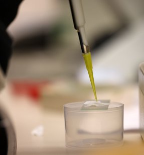 Microplastics are notoriously hard to find, but a student–faculty team at Commonwealth University–Mansfield has been busy building tools to track them in living tissue to better understand their health risks.