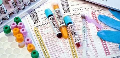 Phlebotomy materials including needles and collection tubes.